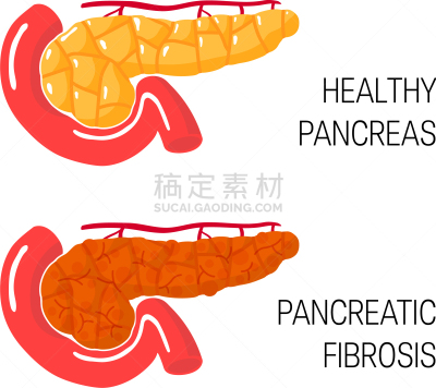 概念,纤维症,白色,分离着色,健康保健,人,药,胞囊的,生病