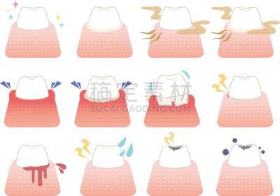 绘画插图,症状,矢量,牙齿,口腔卫生,健康保健,儿童牙科,龋齿,牙医,口臭