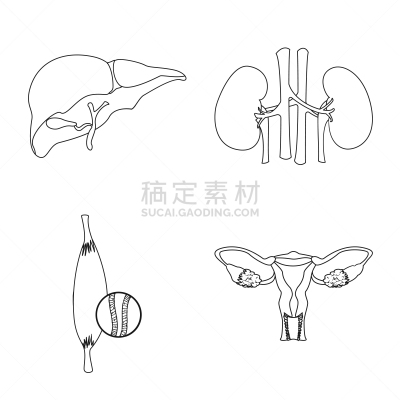 人,分离着色,品牌名称,人造物,人类的生殖器官,卵巢,膀胱,布置