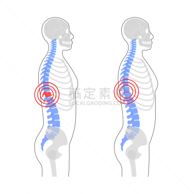 绘画插图,痛苦,矢量,脊柱,健康保健,背景分离,骷髅图,按摩师,脖子,人类骨架
