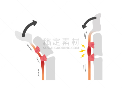 扳机,手指,绘画插图,空白的,背景分离,药,坏掉的,手部骨骼,情绪压力