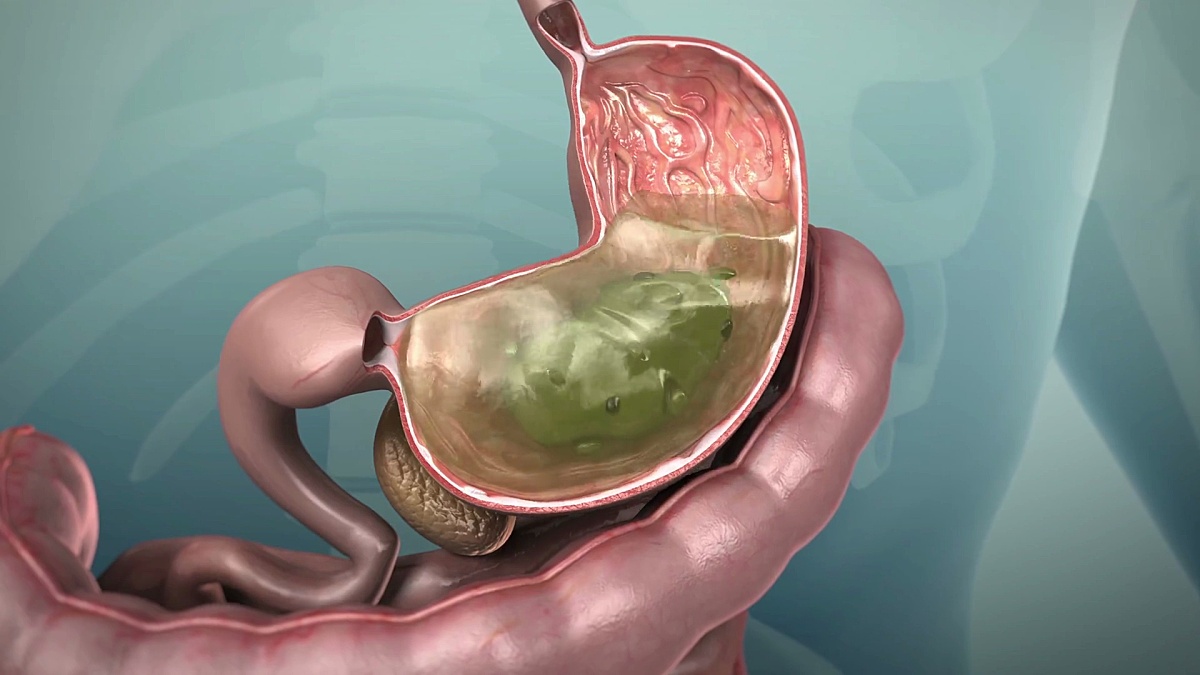 人体胃肠道或胃肠道的3D动画， 超高清。