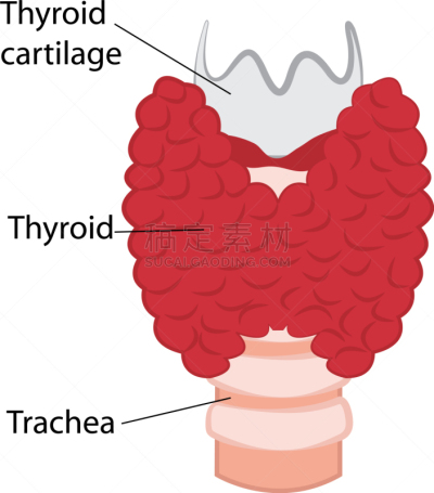 健康保健,甲状腺,甲状腺机能减退,巨大的,人,碘,Goiter,生病