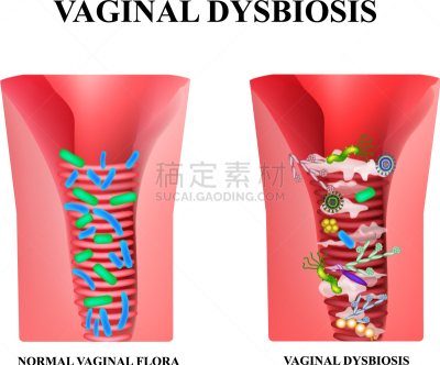 细菌,分离着色,健康保健,显微镜,人,图像,女人,益生菌,生病