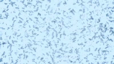 微生物H1N1