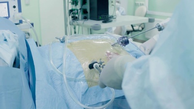 腹腔镜腹部手术