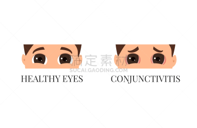 男人,结膜炎,分离着色,症状,人,状态,视力,结膜,沟通,生病