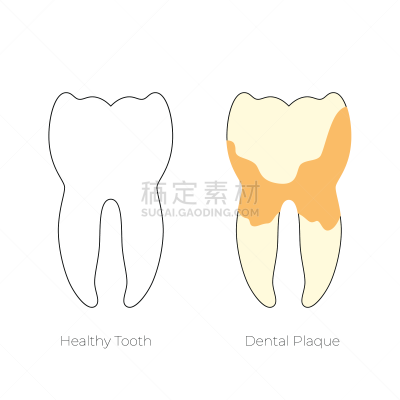 绘画插图,矢量,牙齿,分离着色,口腔卫生,健康保健,珐琅,背景分离,生物膜生物,牙医