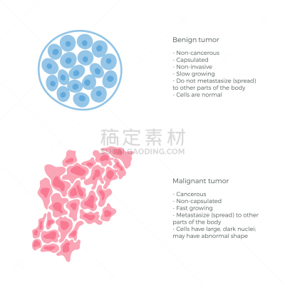 癌症,良性肿瘤,良性的,基础的，基本的,肿瘤学,矢量,细菌,脱氧核糖核酸,生病