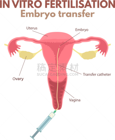 生物学,健康保健,人,图表,图像,人工授精,人类的生殖器官,教育