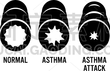 asthma attack
