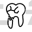 broken tooth