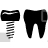 dental implant