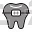Tooth Braces