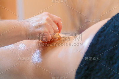 一位hijama大师用真空罐进行背部按摩。