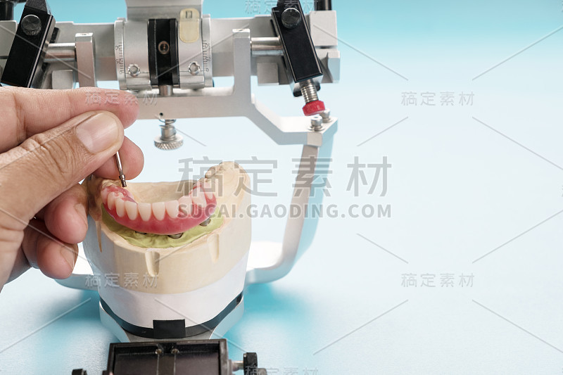 植牙工作已经完成，可以使用了。