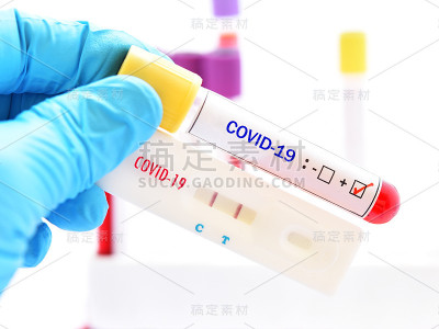 COVID-19病毒阳性检测结果