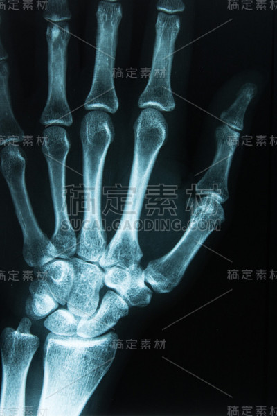 x光扫描手
