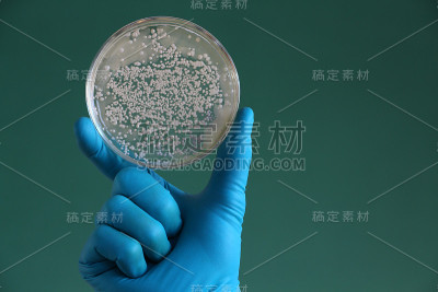 手拿着一个琼脂培养皿