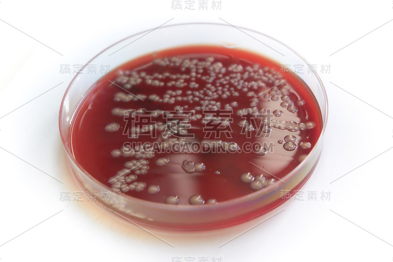 细菌在血琼脂平板上生长