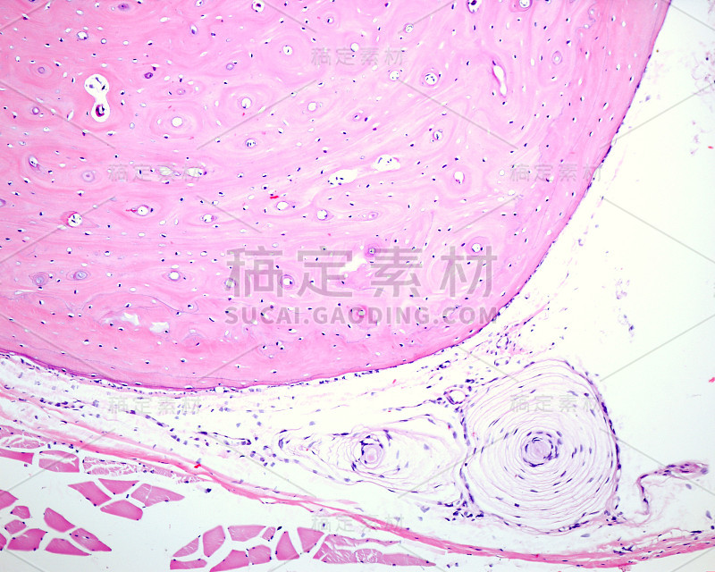 帕西尼氏小体。骨膜