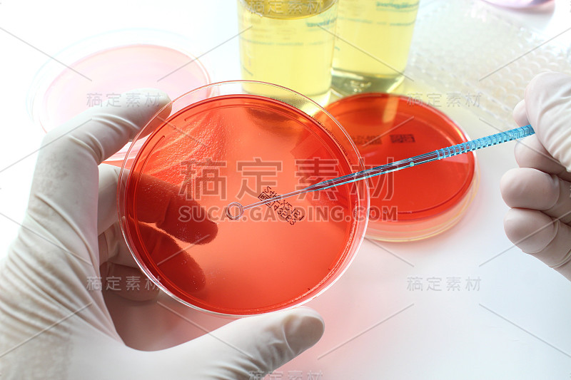 微生物学检查