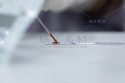 实验室乙型肝炎检测的研究。