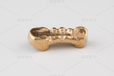 镶金假牙冠