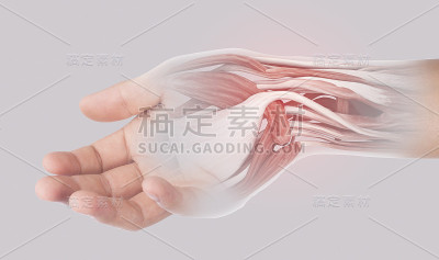 x光腕肌痛