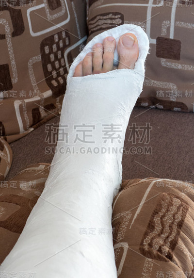 石膏踝关节骨折