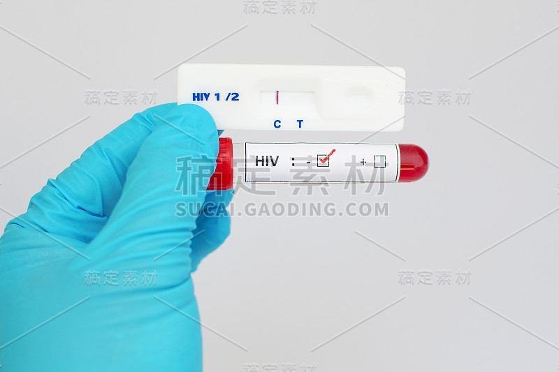 HIV阴性