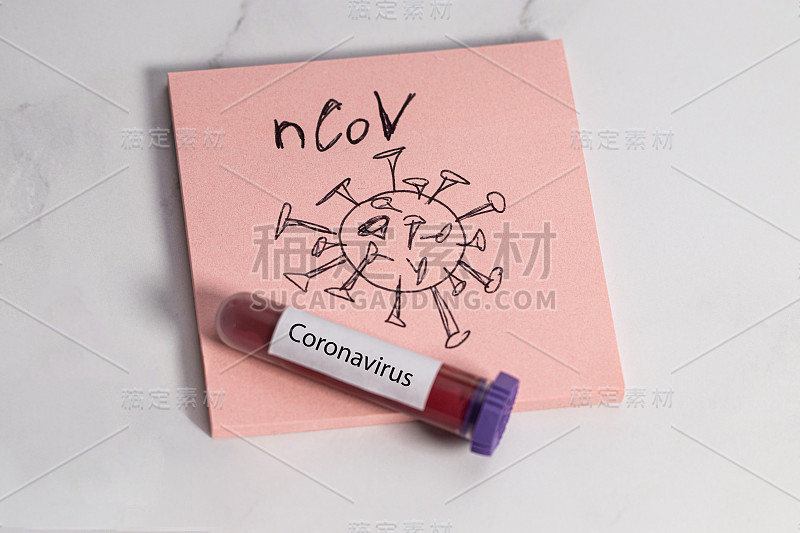 test tube with blood for 2019-nCoV analyzing. COVI