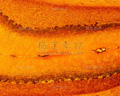 小脑皮质。硝酸银