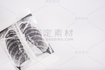 肺部x光片，白色背景，空白，肺炎和支气管炎概念