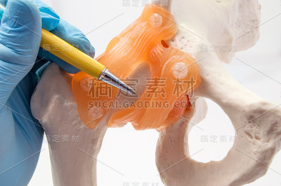 髋关节和骨骼解剖概念照片。医生指出髋关节和骨盆骨的解剖模型与韧带，局部疾病如发育不良，骨折，骨关节炎