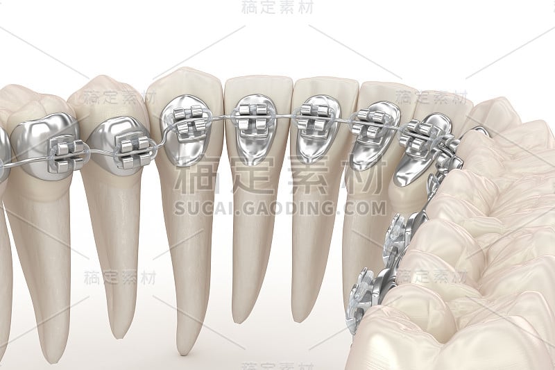 用牙刷清洁牙齿，隔离上白。口腔卫生的医学精确3D插图。