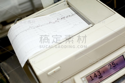 胎儿多普勒