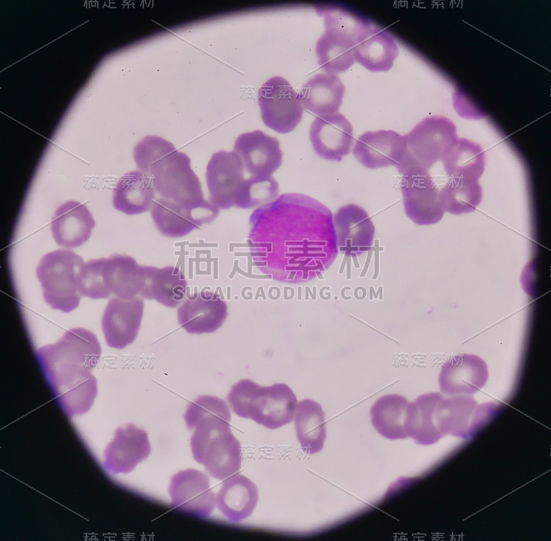 白细胞红细胞背景上的母细胞。