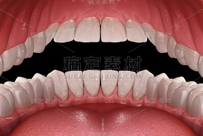 正常咬合的健康人类牙齿，内观形态。医学上准确的牙齿3D插图