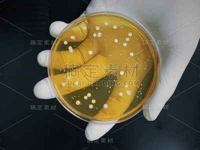 琼脂板上满是微生物和微生物