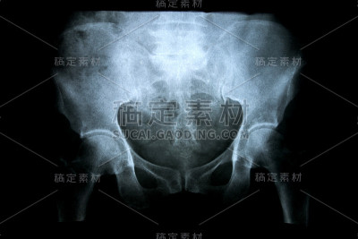 脊柱和肩部的x线平位片