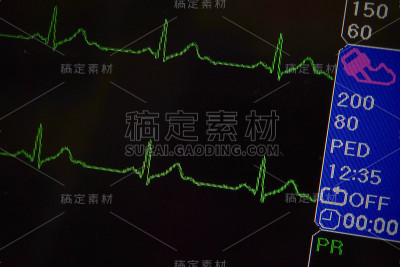 心电图