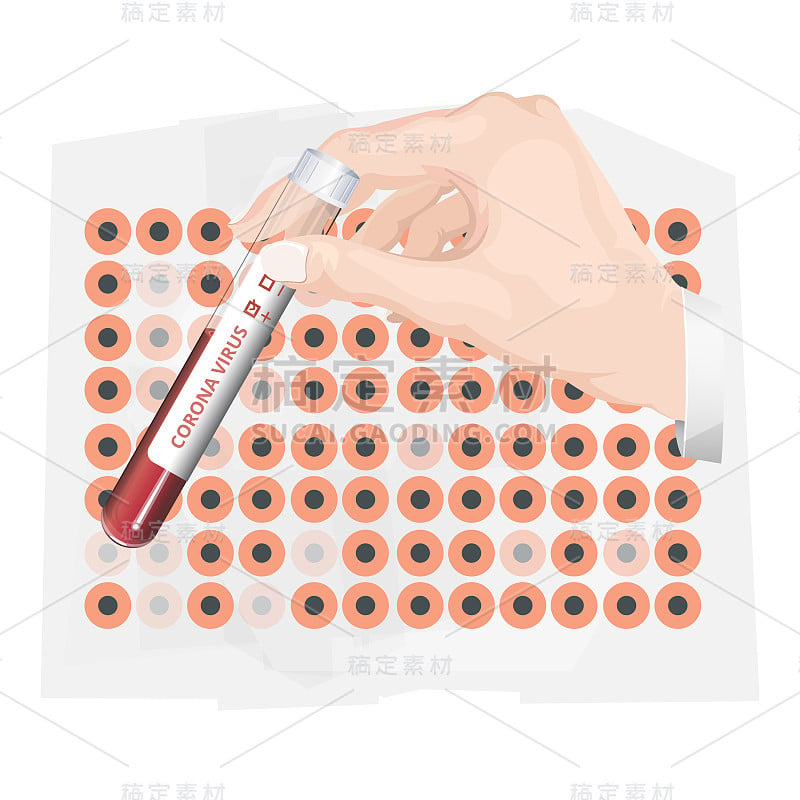 带冠状病毒标签的玻璃采集管中的血液样本-插图