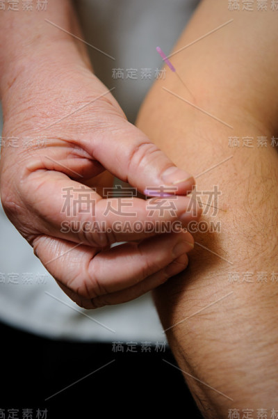 针灸
