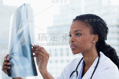 聚焦女医生看一组x光片