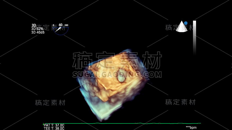 超声波机器屏幕上显示的是心脏的3D图像