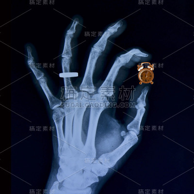 时间是短暂的