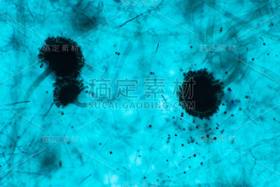 曲霉(霉菌)在显微镜下进行教育。