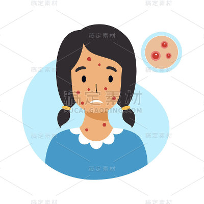 满脸水痘的悲伤女孩。青少年皮肤炎症和痤疮。