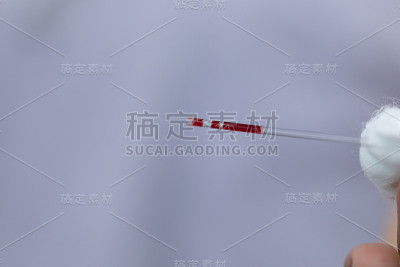 实验室乙型肝炎检测的研究。